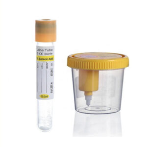 Sterile Vacuum Urine Container